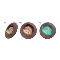 Reliability of wound measurement methods